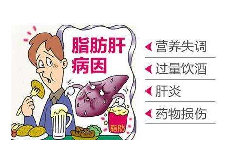 脂肪肝